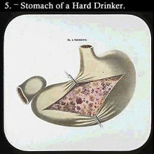 lantern slide temperance stomach drinker